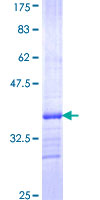 12.5% SDS-PAGE Stained with Coomassie Blue.